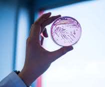 Selektivagarplatte, auf der ein multiresistenter Escherichia coli-Stamm wächst. Selektivagarplatte, auf der ein multiresistenter Escherichia coli-Stamm wächst.