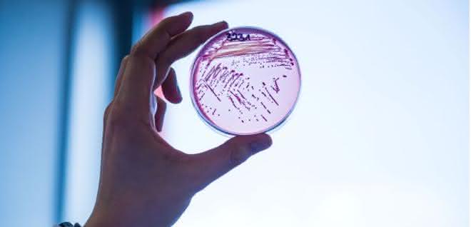 Selektivagarplatte, auf der ein multiresistenter Escherichia coli-Stamm wächst.
