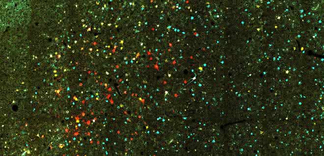 Blick ins Gehirn: Pyramidenbahn-Neurone im Neokortex der Ratte. Die Farben spiegeln die unterschiedlichen Hirnregionen wider, die in diese Zellen die Ergebnisse neuronaler Berechnungen weiterleiten. Farbige Punkte auf dunkelgrünem Grund (unterschiedliche Farben zeigen verschiedene Hirnregionen)