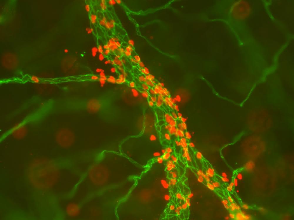 Blutgefäße einer Maus, dargestellt mit hochauflösender Mikroskopie. Forscher des Cells in Motion Interfaculty Centres untersuchen unter anderem Entzündungsreaktionen, bei denen Zellen des Immunsystems (rot) aus den Blutgefäßen (grün) ins Gewebe wandern und dort Infektionen bekämpfen oder Gewebeschäden reparieren. Mikroskopische Aufnahme von Blutgefäßen einer Maus.