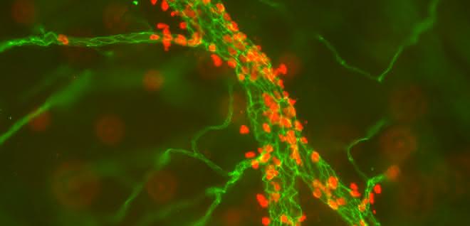 Blutgefäße einer Maus, dargestellt mit hochauflösender Mikroskopie. Forscher des Cells in Motion Interfaculty Centres untersuchen unter anderem Entzündungsreaktionen, bei denen Zellen des Immunsystems (rot) aus den Blutgefäßen (grün) ins Gewebe wandern und dort Infektionen bekämpfen oder Gewebeschäden reparieren. Mikroskopische Aufnahme von Blutgefäßen einer Maus.