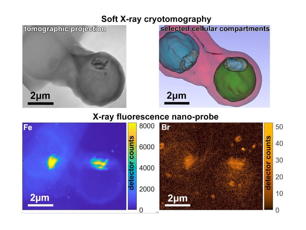 Die Kombination mehrerer Messmethoden an den Synchrotronquellen BESSY II, ALBA und ESRF zeigt, wie Bromoquin den Entgiftungsprozess der Plasmodien stört. Bilder der Kombination mehrerer Messmethoden an den Synchrotronquellen BESSY II, ALBA und ESRF