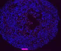 Im Inneren des Spheroids sterben Zellen am programmierten Zelltod Apoptose (pink) Im Inneren des Spheroids sterben Zellen am programmierten Zelltod Apoptose (pink)