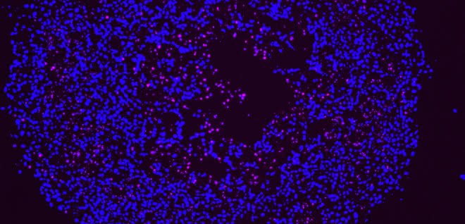 Im Inneren des Spheroids sterben Zellen am programmierten Zelltod Apoptose (pink) Im Inneren des Spheroids sterben Zellen am programmierten Zelltod Apoptose (pink)
