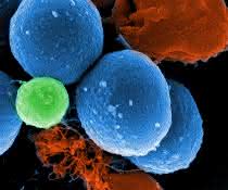 Rasterelektronenmikroskopische Aufnahme von intakten MRSA (blau), durch die Wirkung von PK150 induzierte Vesikelbildung (grün) und durch PK150 zerstörte MRSA (rot). Rasterelektronenmikroskopische Aufnahme (unterschiedliche Bereiche farbig dargestellt)