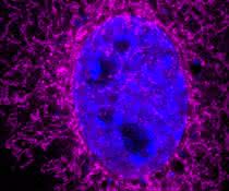 Das ARHGAP11B-Protein (Magenta) ist in den Mitochondrien vorhanden. Der Zellkern wird durch DAPI (blau) visualisiert. Bild, in dem das ARHGAP11B-Protein im Mitochondrium und der Zellkern farbig dargestellt sind.