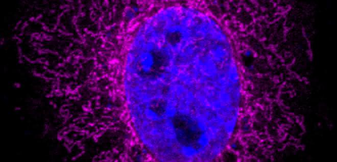 Das ARHGAP11B-Protein (Magenta) ist in den Mitochondrien vorhanden. Der Zellkern wird durch DAPI (blau) visualisiert. Bild, in dem das ARHGAP11B-Protein im Mitochondrium und der Zellkern farbig dargestellt sind.