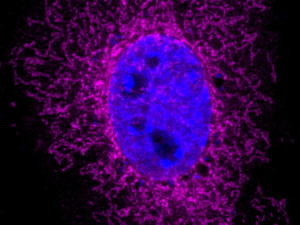 Bild, in dem das ARHGAP11B-Protein im Mitochondrium und der Zellkern farbig dargestellt sind.