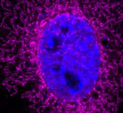Bild, in dem das ARHGAP11B-Protein im Mitochondrium und der Zellkern farbig dargestellt sind.