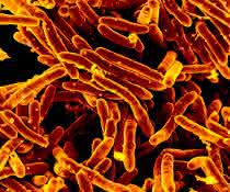 Elektronenmikroskopische Aufnahme des Tuberkuloseerregers
