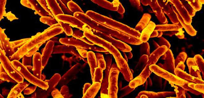 Elektronenmikroskopische Aufnahme des Tuberkuloseerregers