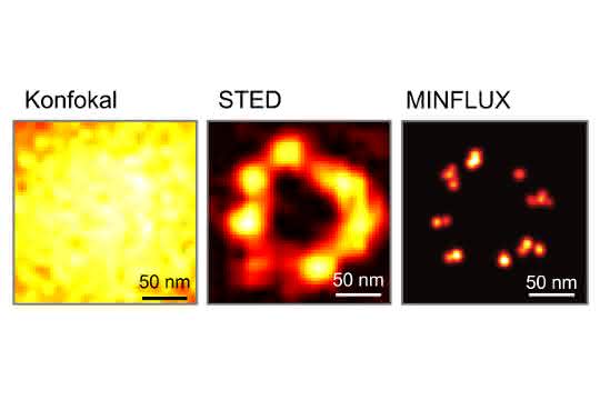 Der Vergleich dokumentiert die epochalen Auflösungs-Durchbrüche in der Fluoreszenzmikroskopie