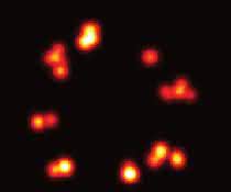 Der Vergleich dokumentiert die epochalen Auflösungs-Durchbrüche in der Fluoreszenzmikroskopie