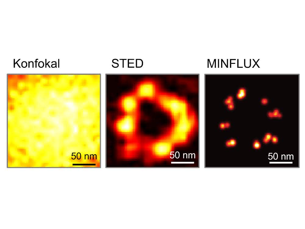 Der Vergleich dokumentiert die epochalen Auflösungs-Durchbrüche in der Fluoreszenzmikroskopie