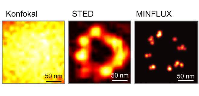 Der Vergleich dokumentiert die epochalen Auflösungs-Durchbrüche in der Fluoreszenzmikroskopie