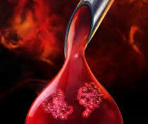 Thermal profiling identifies drug-protein and protein-protein interactions in blood and tissue. Abstracted: Protein interaction in a blood drop