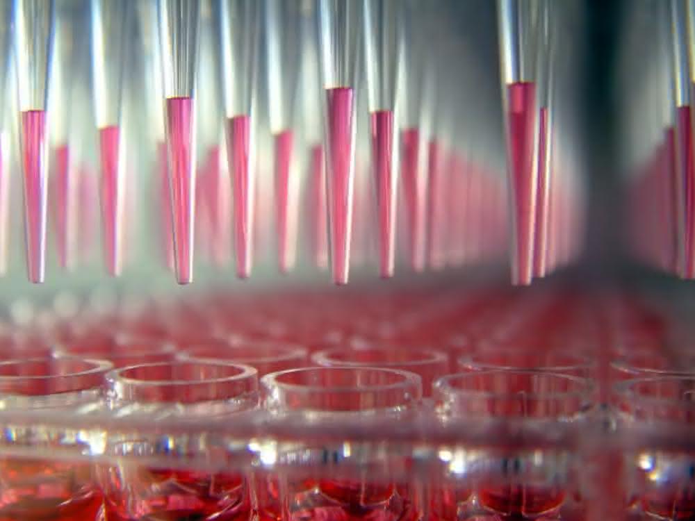 Automatisiertes Pipettieren