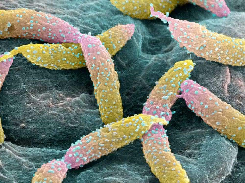 Caulobacter crescentus
