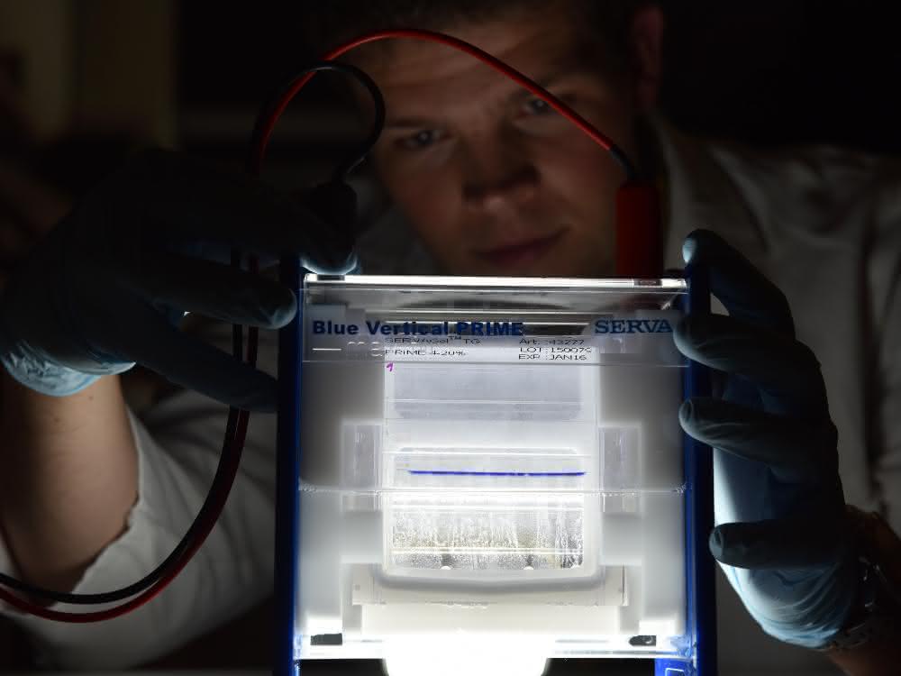 Gel zum Auftrennen der Histone