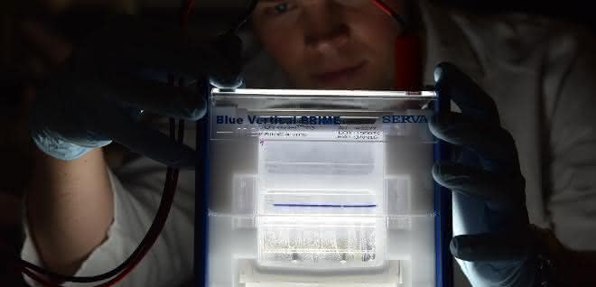 Gel zum Auftrennen der Histone
