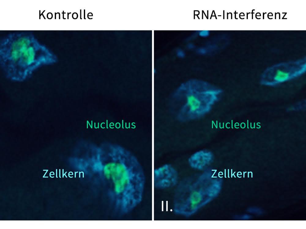 Die Größe des Nucleolus ist ein Altersmarker im Fadenwurm C. elegans Nucleolus des Fadenwurms C. elegans