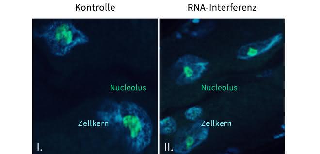 Nucleolus des Fadenwurms C. elegans