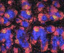 Milz einer Maus mit fluoreszierenden Antikörpern. In den gelben Arealen befinden sich die TFH-Zellen, die an der Aufrechterhaltung des immunologischen Gedächtnisses beteiligt sind Milz einer Maus mit fluoreszierenden Antikörpern