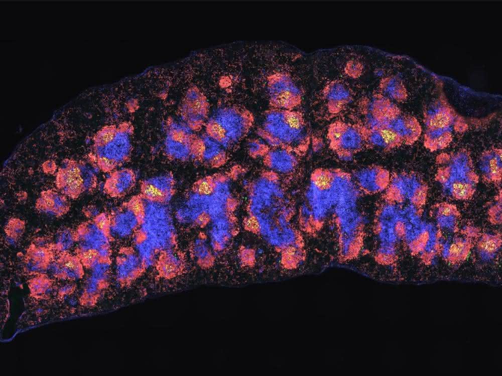 Milz einer Maus mit fluoreszierenden Antikörpern