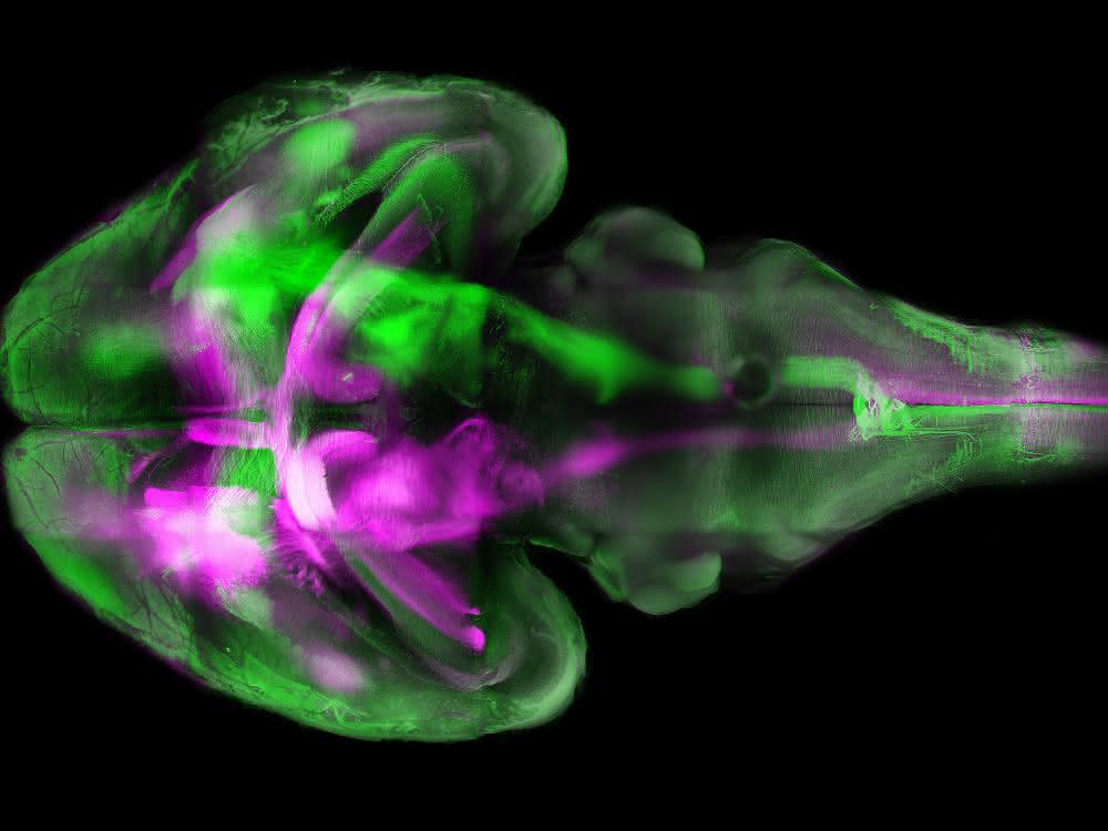 Das Gehirn einer Maus - aufgenommen mit Fluoreszenz-Mikroskopie unter Nutzung der "Tissue Clearing"-Technik zum Transparent-Machen von Gewebe. Fluoreszenz-Mikroskopische Aufnahme