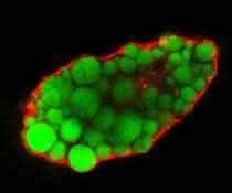 Lipidtropfen in einer Fettzelle