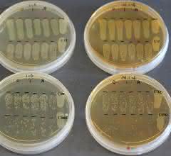 Agarplatten mit Pseudomonas-Bakterien (Versuchsreihe)