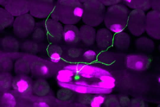 Fluoreszenzmikroskopische Aufnahme