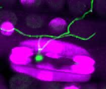 Fluoreszenzmikroskopische Aufnahme