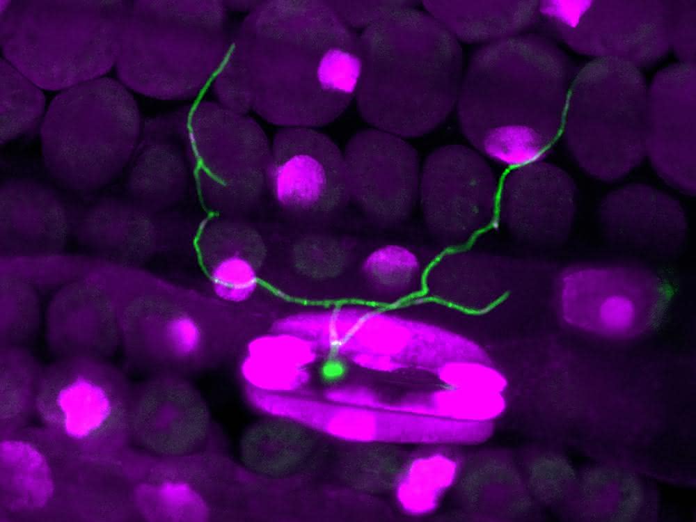 Fluoreszenzmikroskopische Aufnahme