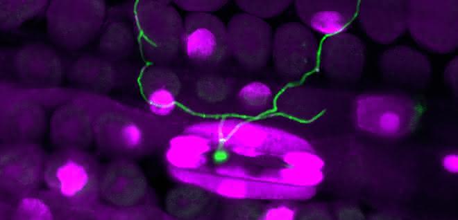 Fluoreszenzmikroskopische Aufnahme