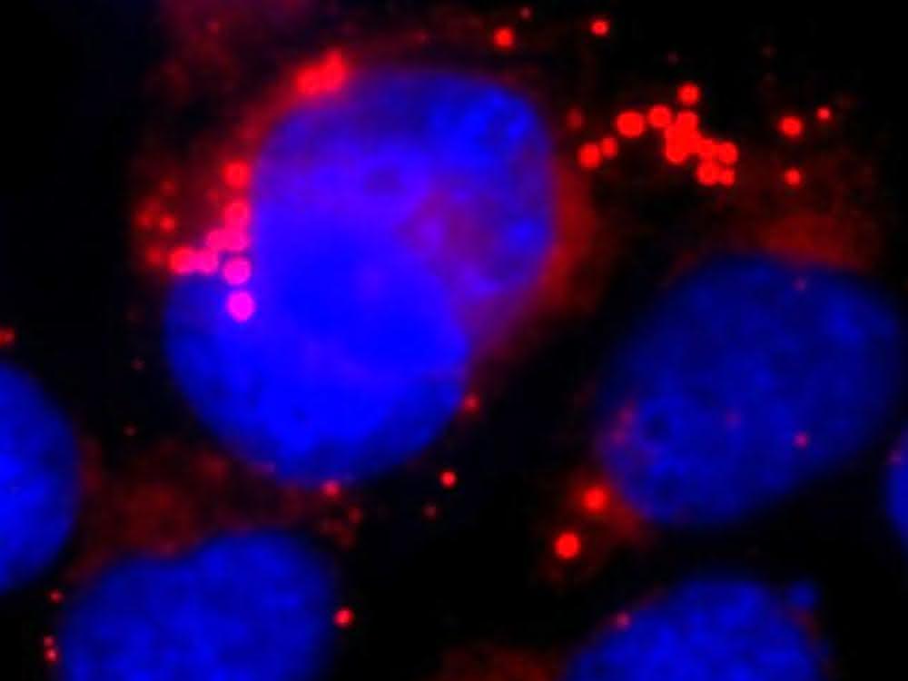 Astrozyten mit Lipidtröpfchen