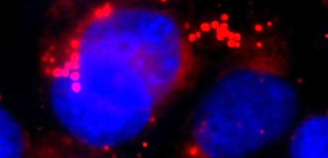 Astrozyten mit Lipidtröpfchen
