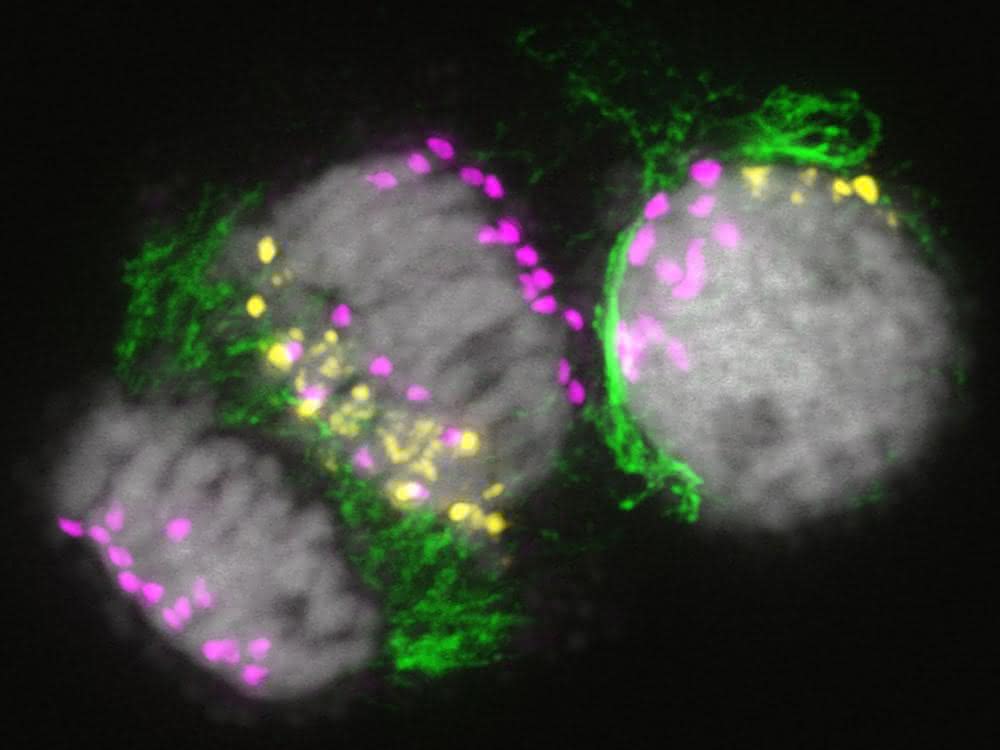 Mitotische Zellen während der Eliminierung von B-Chromosomen