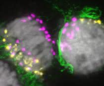 Mitotische Zellen während der Eliminierung von B-Chromosomen Mitotische Zellen während der Eliminierung von B-Chromosomen