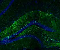 Hippocampus einer Maus