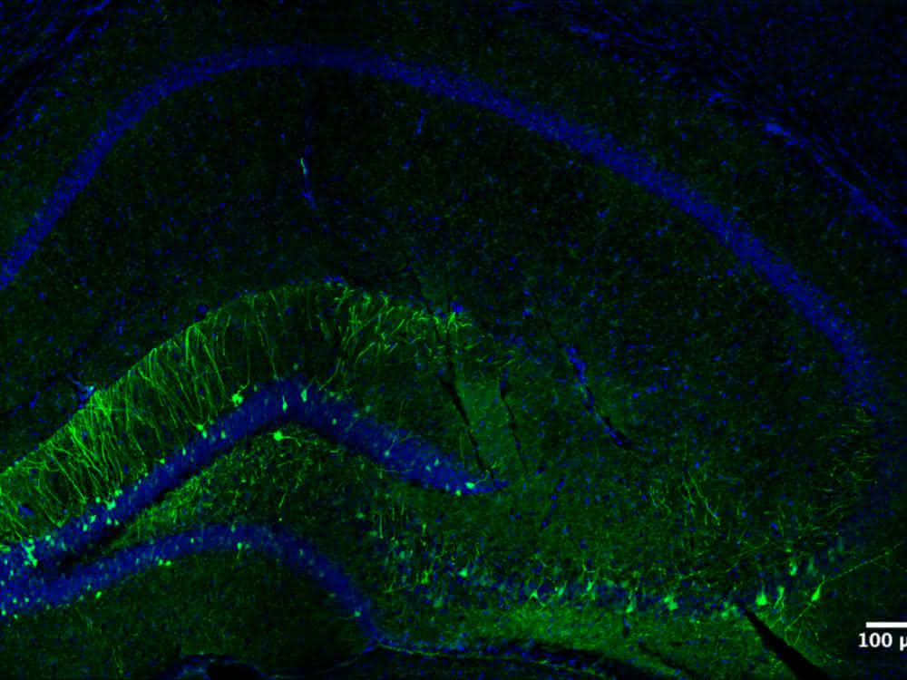 Der Teil des Hippocampus einer Maus, der beim Erlernen der neuen Aufgabe aktiviert wird Hippocampus einer Maus