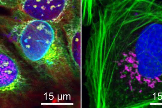 Fluoreszierende Zellen Fluoreszierende Zellen