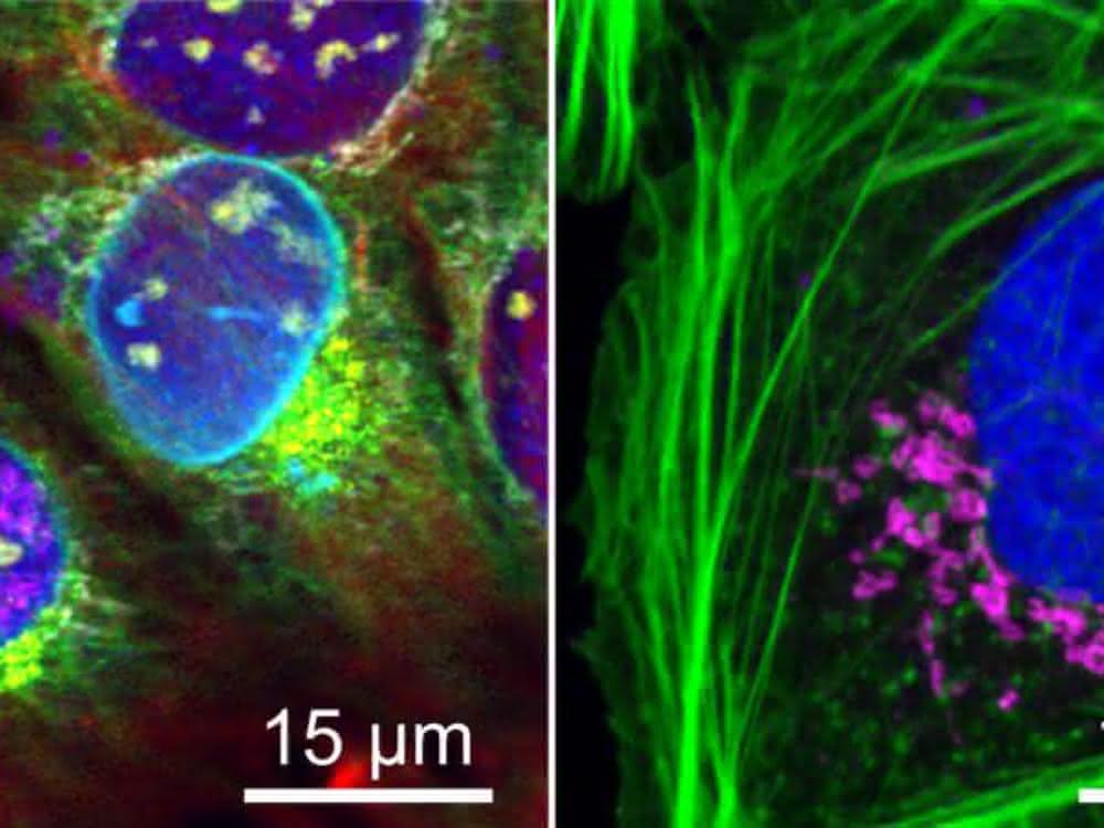 Fluoreszierende Zellen