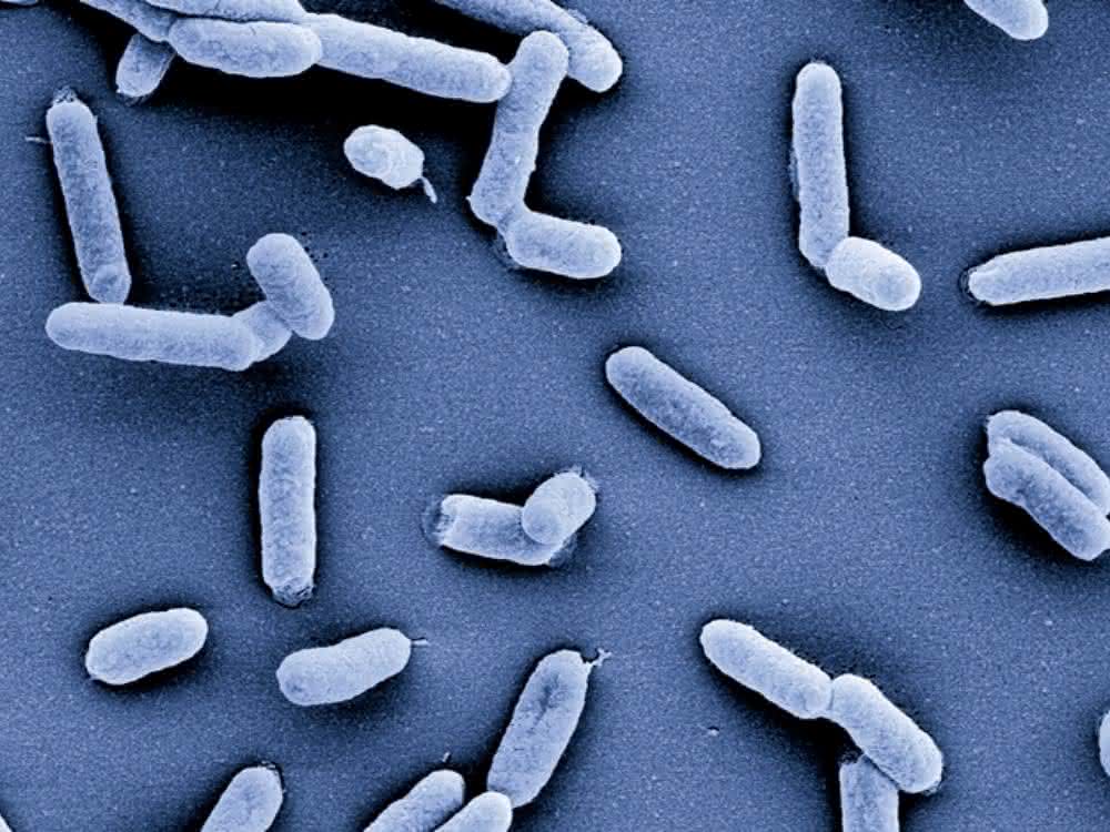 Salmonellen dienten in der Studie zur RNA-Einzelzelllsequenzierung als Modellorganismus. Salmonellen