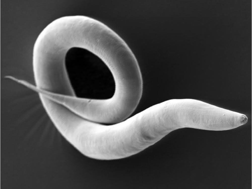 Caenorhabditis elegans