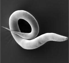Caenorhabditis elegans