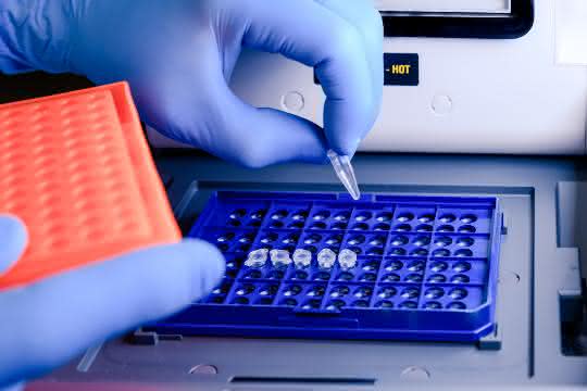 Behandschuhte Hand befüllt PCR-Thermocycler