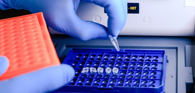 Marktübersicht: PCR-Thermocycler Behandschuhte Hand befüllt PCR-Thermocycler