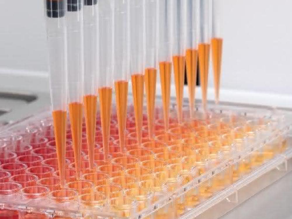 Ein Blick in die Gerätetechnik: Automatisiertes Pipettieren – was steckt drin? Automatisiertes Pipettieren