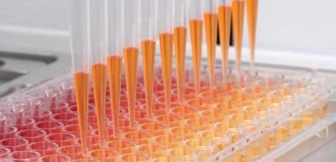 Ein Blick in die Gerätetechnik: Automatisiertes Pipettieren – was steckt drin? Automatisiertes Pipettieren